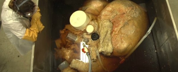 Incredible first look at the largest heart humans have ever preserved