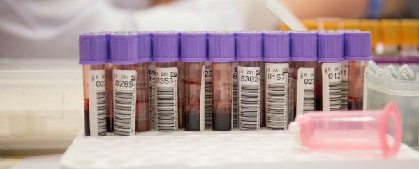 Scientists have identified an antibody that neutralises 98% of HIV strains