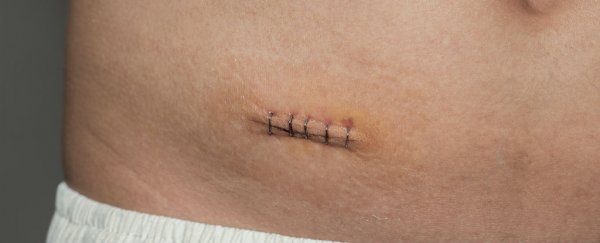 Your appendix might serve an important biological function after all