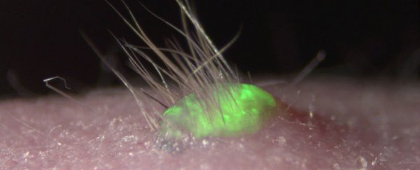 This lab-grown skin can sprout new hairs and sweats