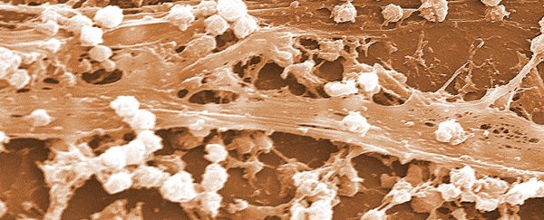 We now know bacteria can communicate electrically, and we should be worried