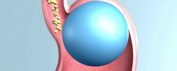5 people are dead after undergoing FDA-approved obesity treatment