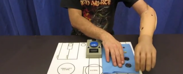 World first: Three men replace damaged arms with mind-controlled prosthetics