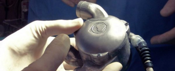 This world-first bionic heart works without a pulse