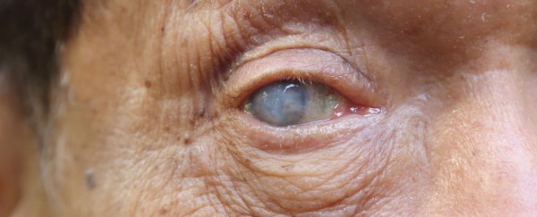 Scientists figure out how to restore vision in blind mice