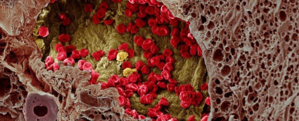 Scientists have finally figured out how cancer spreads through the bloodstream
