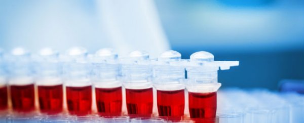 New Alzheimer’s test detects disease 10 years before diagnosis