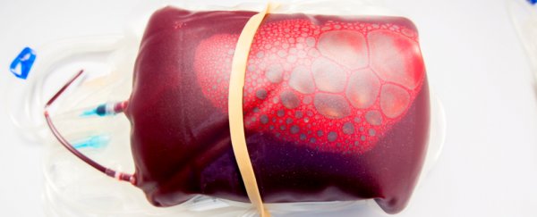 Human trial shows little promise for young people's blood as dementia treatment