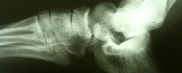 Scientists have used 'pregnancy fluid' to strengthen ageing bones