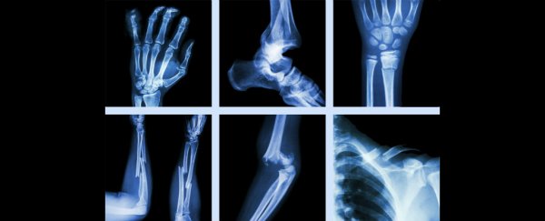 Farming made human bones fragile