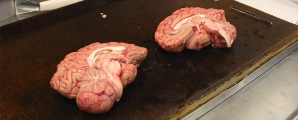 Welcome to the world's largest brain bank