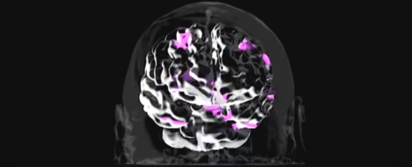 WATCH: This is your brain on music