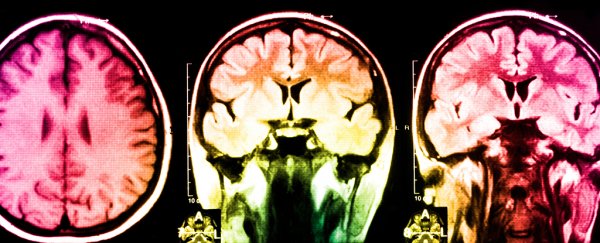 Creative people have better-connected brains, scans reveal