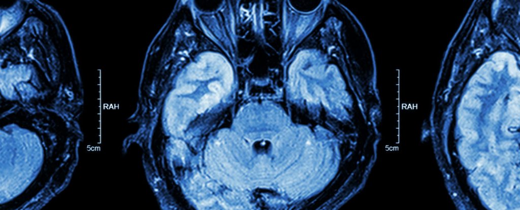 New Pacemaker For The Brain Is Set to Change The Way We Treat Mental Illness