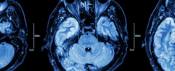 New pacemaker for the brain is set to change the way we treat mental illness