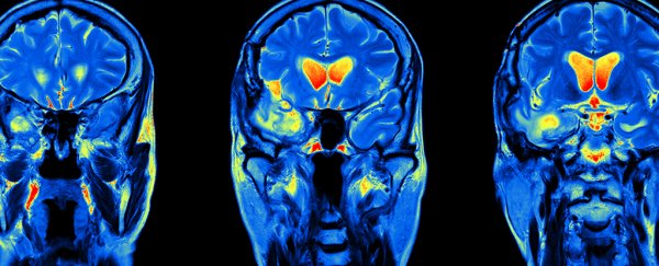 This malaria drug is having an amazing effect on brain cancer patients