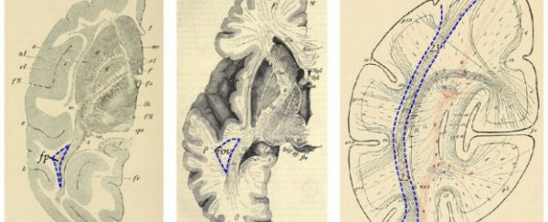 Neuroscientists 'rediscover' entire brain region linked to reading