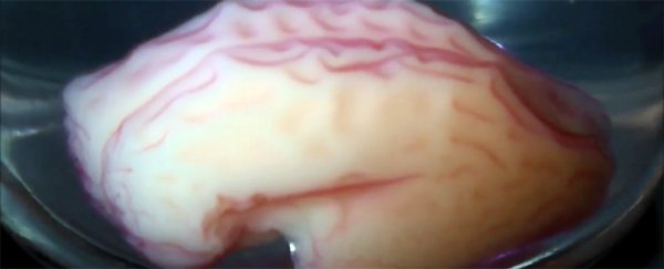 This artificial 3D brain shows how our wrinkles and folds take shape