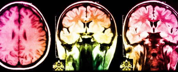 There's a big problem skewing neuroscience - we're not all white and middle class