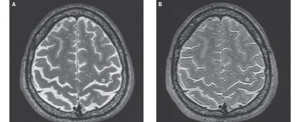 Here's what long-term living in space does to astronaut brains