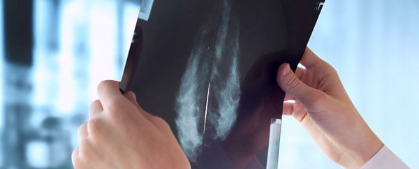 Breast cancer growth is halted by osteoporosis drug, study finds