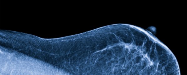 Breasts have their own microbiome - and it could influence your cancer risk