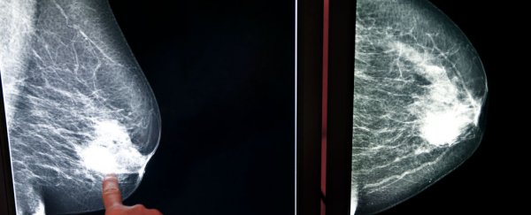 New blood test could predict breast cancer relapse
