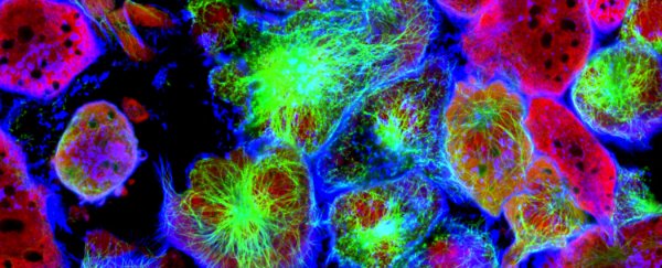 Scientists find a way to get cancer cells to grow normally again