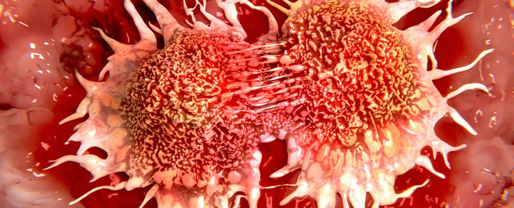 We Now Have The Most Precise Timeline Ever of a Cancer ...