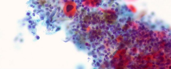This new computer program can diagnose cancer in just two days