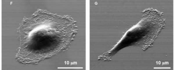 Scientists are closer to understanding how cancer cells spread in the body