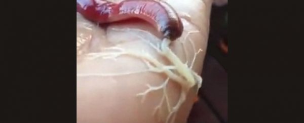 WATCH: This creepy worm is trying to digest a person's hand