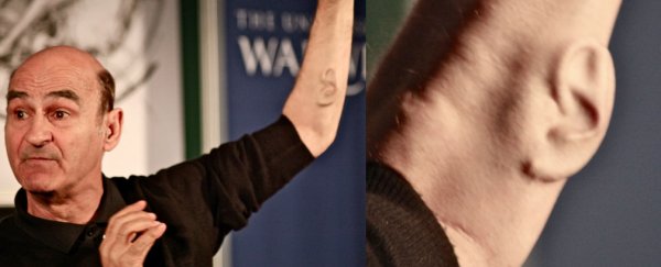 Australian man grows ear on arm to make ‘remote listening device’ for the Internet