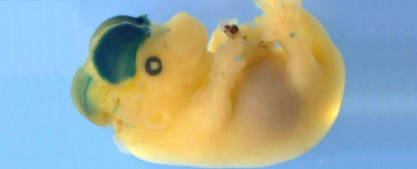Scientists identify the gene that makes our brains bigger