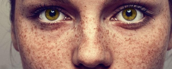 Freckled face close up