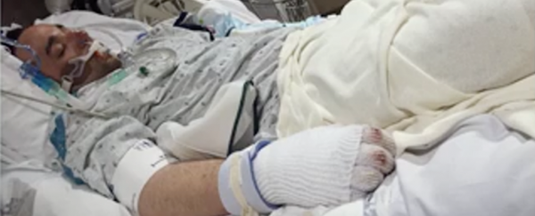 Being frozen almost to death is what saved this man's life