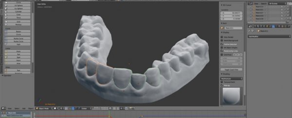 This guy fixed his teeth by 3D-printing his own plastic braces for $60