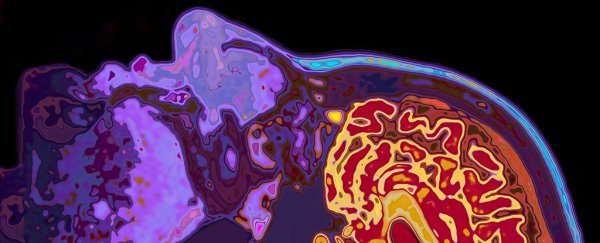Newly discovered broken brain links could be why Parkinson's causes hallucinations