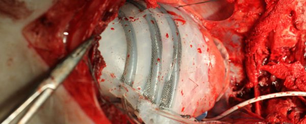 WATCH: This crazy heart-hugging robot could save the lives of transplant patients