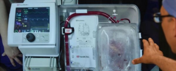 First non-beating heart transplant performed successfully in the UK