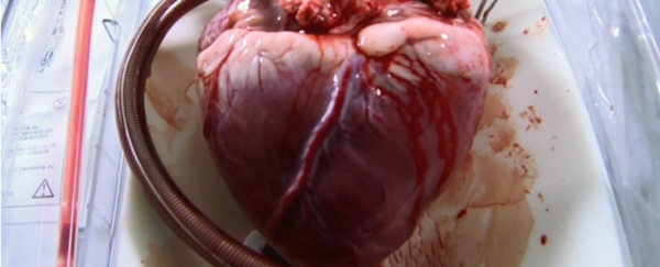 Government researchers in the '60s tried to build hearts fuelled by radioactive decay