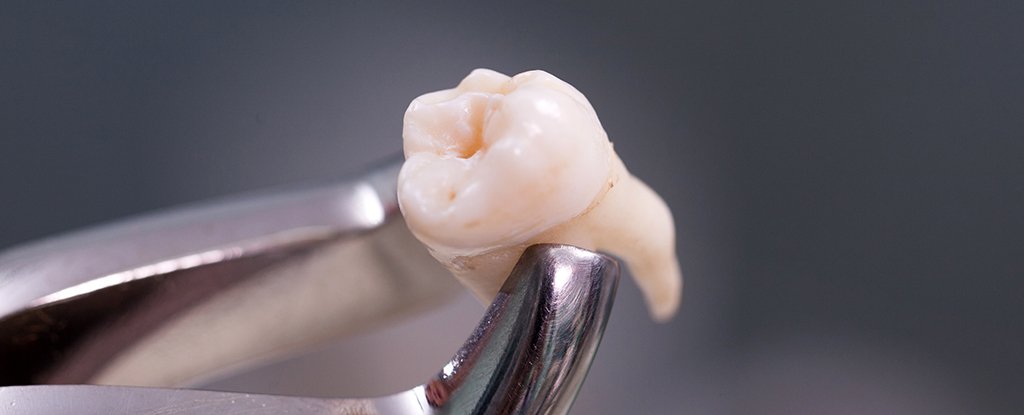 Researchers Now Know in Uncomfortable Detail Exactly What Chewing Does to Our Teeth