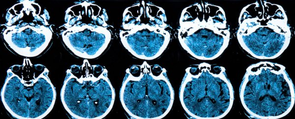 First drug for Huntington's disease proves safe and effective in mice and monkeys