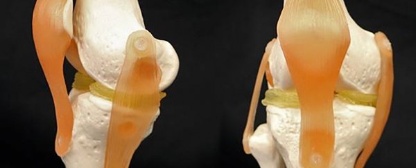 New hydrogel that mimics cartilage could make knee repairs easier