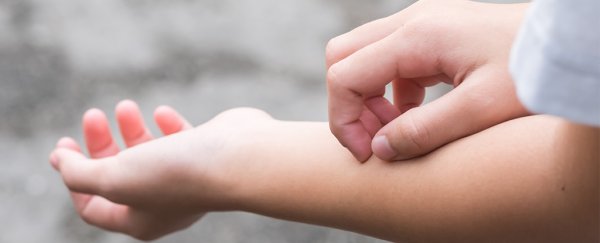 Scientists have found the spot in your brain that makes you itch when others scratch