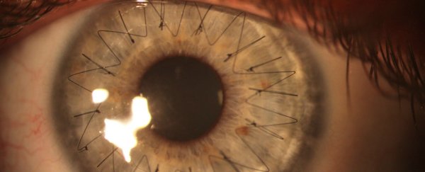 Whoa, this is what eyeball stitches look like