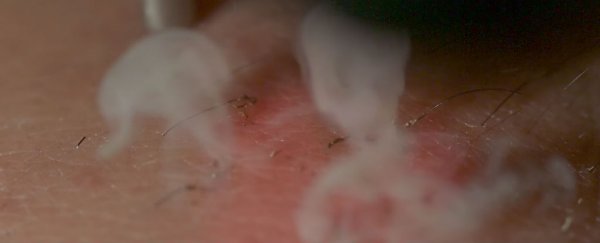 WATCH: The science of laser hair removal in SLOW MOTION