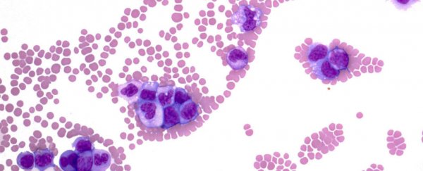 Scientists transform human leukaemia cells into functional immune cells