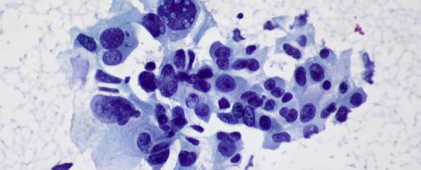 Starving cells of sugar could be the key to future cancer treatments