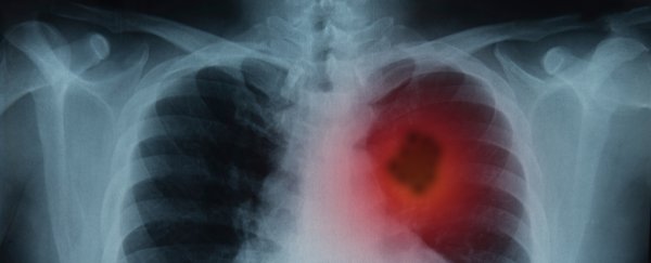 Vitamin B has been linked to lung cancer, but you probably don't need to worry